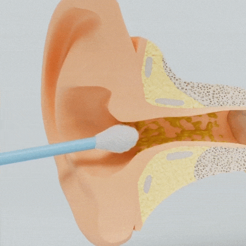 VoluGen™ HydroClear Pro